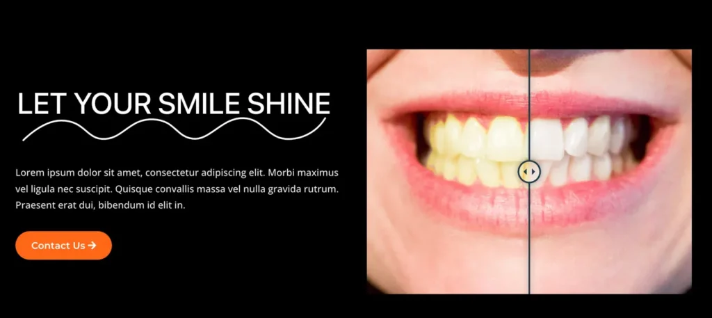 Dental care feature section for Elementor
